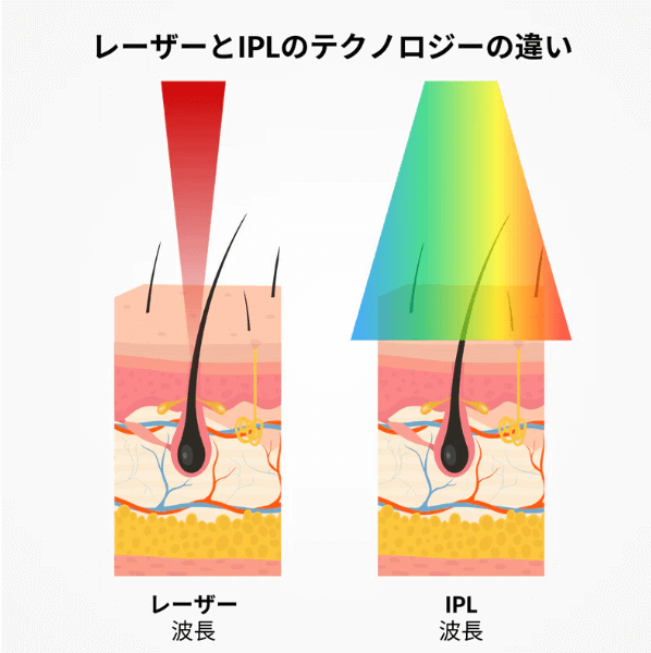 CurrentBody skin レーザーヘアリムーバル